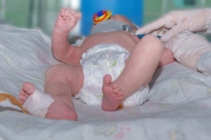 Port St. Lucie Birth Injury Lawyer