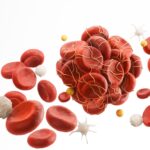 Can the Depo Shot Cause Blood Clots?