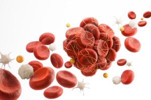 Can the Depo Shot Cause Blood Clots?